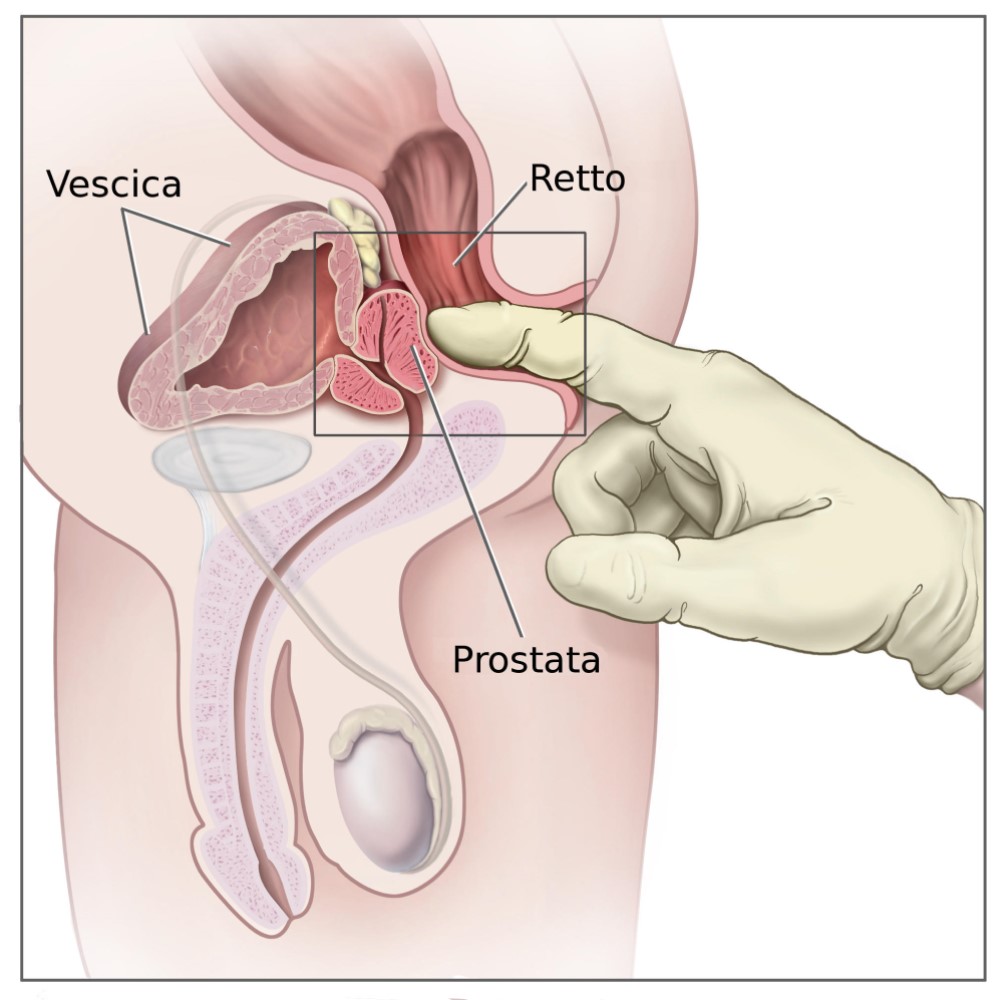 Disegno anatomico maschile con prostata